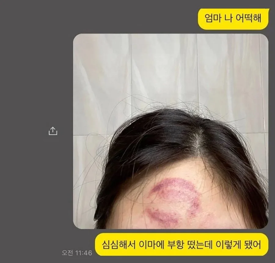 머리에 부황뜬 딸이 한심했던 어머니