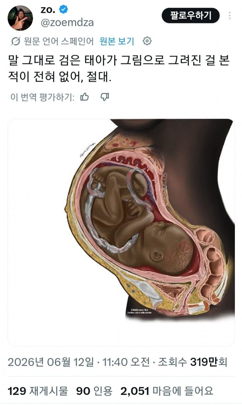 흑인 아기들은 검은 피부로 태어나지 않아요